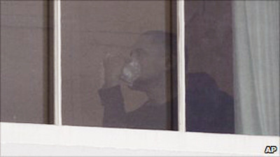 Tổng thống Obama bị rách môi