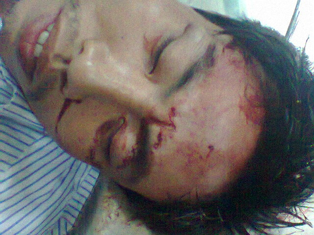 Côn đồ chém người dã man