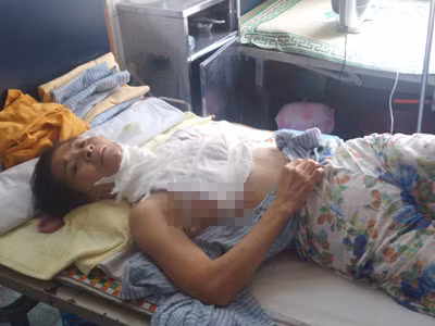 Bà Đỗ Thị Thiêm tại khoa bỏng, bệnh viện Xanh Pôn sáng 18/7. Ảnh: Tuấn Nguyễn