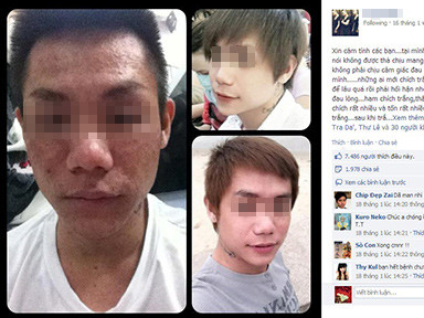 'Hot boy' hóa 'dị nhân' bởi tẩy trắng da