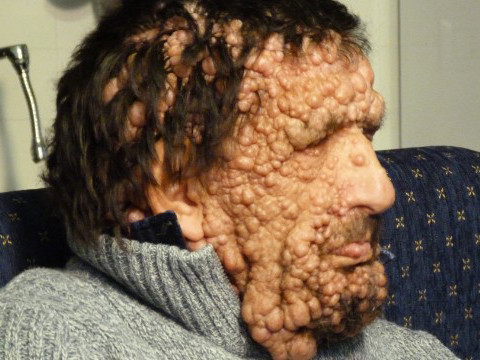 Anh Vinicio Riva, 53 tuổi