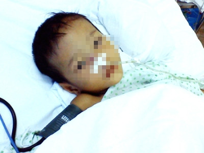 Bé trai 3 tuổi bị bạn gái của bố đánh nhập viện