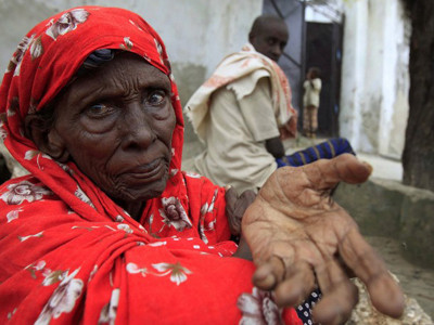 Người nghèo ở Ethiopia ăn lá cây để sống