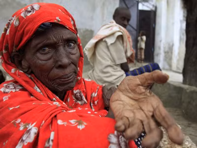 Người nghèo ở Ethiopia ăn lá cây để sống
