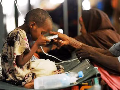 80 trẻ em Somalia tử vong do dịch tả
