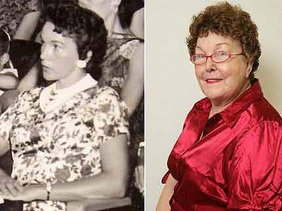 Những ca phẫu thuật thẩm mỹ kinh điển