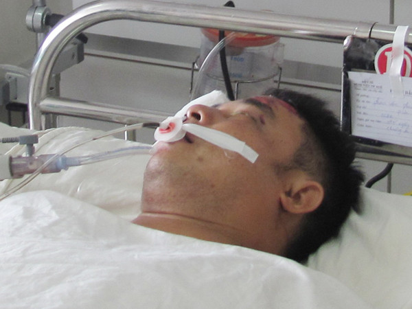 Gặp nạn lúc làm nhiệm vụ, 1 cảnh sát nguy kịch