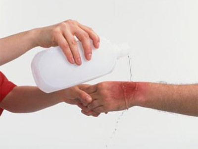 Gia tăng trẻ em tử vong do tai nạn thương tích