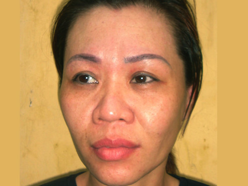 Nữ quái giấu 100 viên ma túy vào chỗ 'kín'