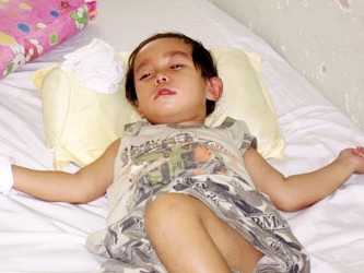 BV nhận thiếu sót vụ bé 29 tháng tuổi bị mù và liệt