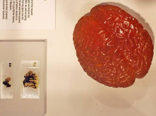 Trưng bày một phần não bộ của thiên tài Einstein