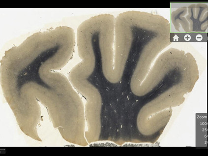 Não của Einstein lên iPad