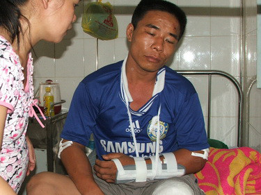 Đi đòi nợ bị vây đánh gãy tay, chân