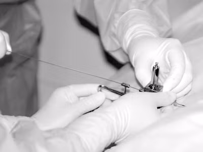 không cần phẫu thuật cắt bỏ
