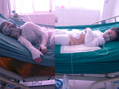 Tạt axit cả gia đình 'bạn gái' vì bị cấm yêu bé 10 tuổi