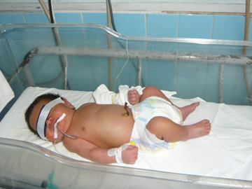 Sơ sinh nghi bị mẹ bóp mũi vứt vào thùng rác