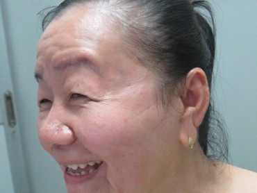 Gương mặt chị Phượng tiếp tục trẻ thêm