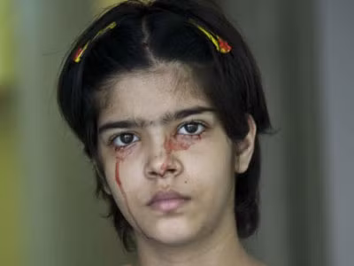 Căn bệnh bí ẩn khóc ra máu