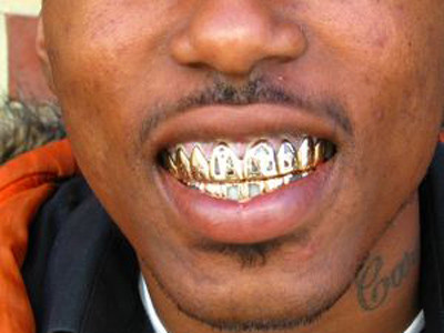 Thoát chết vì đạn trúng... răng vàng