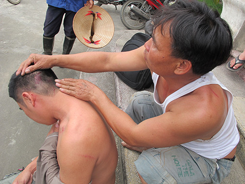 Vụ côn đồ đánh dân Tiên Lãng: Nhiều nhóm tham gia