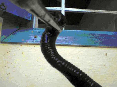 Vắt dài 10 cm đen trũi trong mũi người