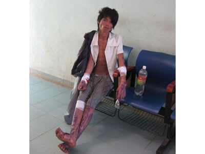 Phát hiện 'người rừng' trốn trong hang đá