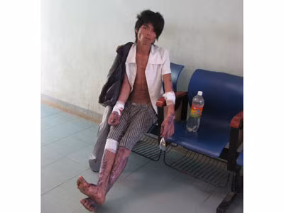 Phát hiện 'người rừng' trốn trong hang đá