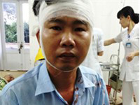 Vung kiếm chém tài xế xe buýt nhập viện