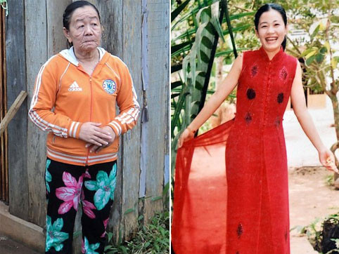 Cô gái biến thành bà lão có thể sinh con bình thường?