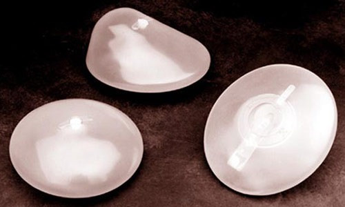Tai biến vì bị lừa bơm silicon vào ngực
