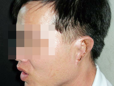 Khai trừ Đảng Phó bí thư xã bị người tình xẻo tai