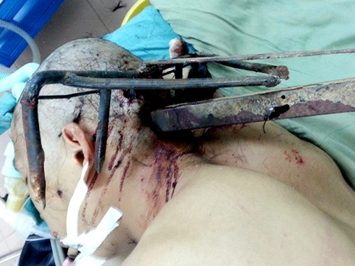 Anh Tiền bị cào sắt bổ vào đầu