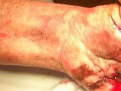 Nghi án đánh thuốc nổ sát hại bằng đèn pin