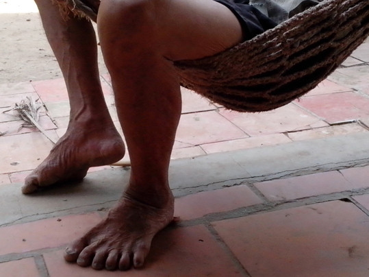 Dòng họ 24 ngón ở xứ dừa