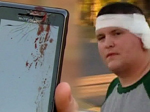 Điện thoại phát nổ gây chấn thương nặng