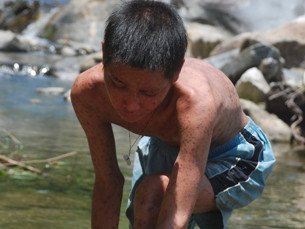 Bệnh lạ ở Quảng Ngãi: vẫn bế tắc