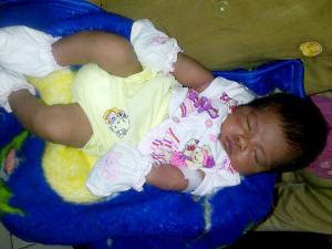 Bé trai sơ sinh khóc ra máu