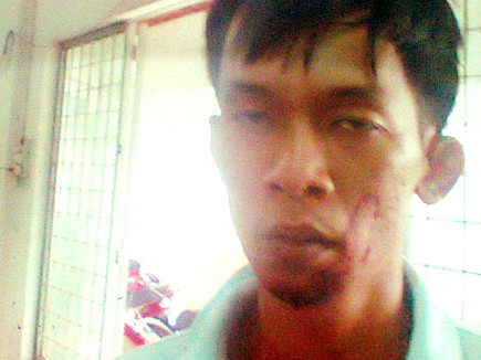 Bắt giam nguyên trung úy CSCĐ tấn công CSGT