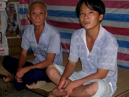 Gia đình ba đời chỉ có một ngón tay