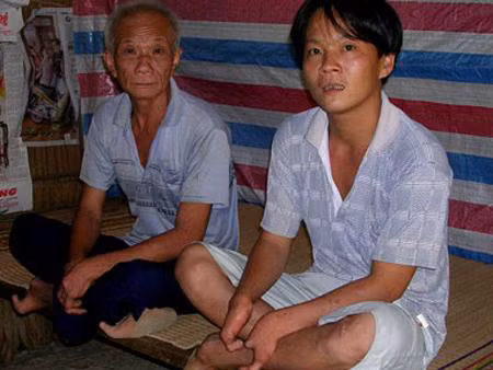 Gia đình ba đời chỉ có một ngón tay