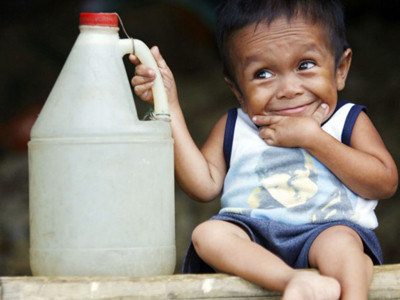 Anh chàng 18 tuổi cao… 60cm