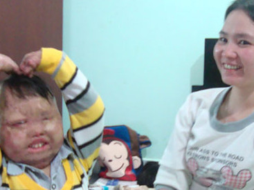 Cậu bé bị bố đốt và hành trình tìm lại tuổi thơ