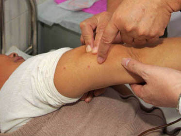 Phát hiện virus trong ve chó làm hàng chục người chết