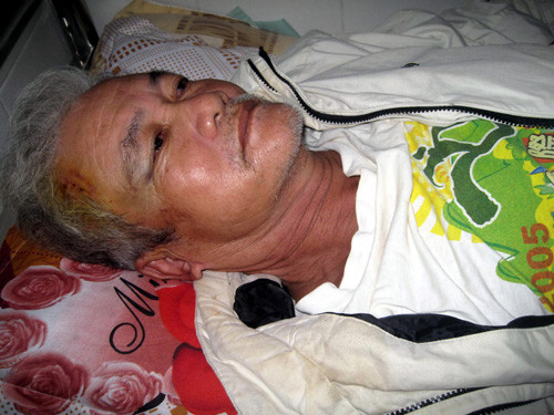 Phó giám đốc Sở Tư pháp Phú Yên cầm cây đánh vào đầu dân