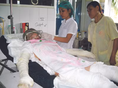 Bác sĩ đang hỏi thăm sức khỏe bệnh nhân bị bỏng Ảnh: Thái Hà