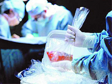 Bỏ tù bốn kẻ buôn bán nội tạng người