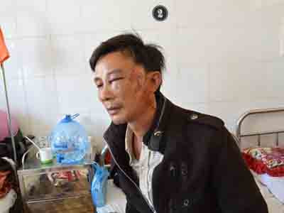 Côn đồ chặn xe, ném đá, cướp tài sản