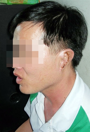 Phó Bí thư bị người tình xẻo tai làm đơn bãi nại