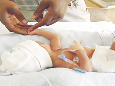 Bé Lehlohol được cứu sống kịp thời tại bệnh viện tư