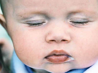 Chụp cắt lớp cho biết sự phát triển não bộ ở trẻ sơ sinh